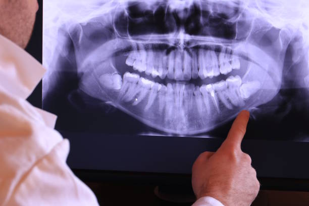 Best Emergency Dental Care for Broken or Chipped Teeth in Adrian, MN